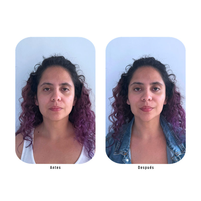 Antes y después Lumina — Firmeza