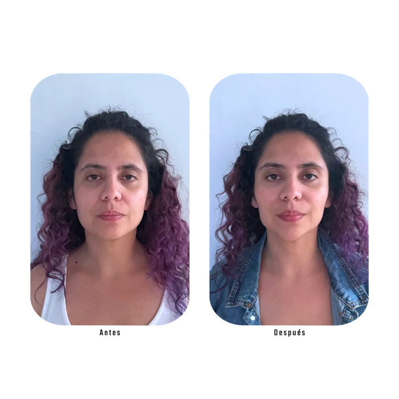 Antes y después Lumina — Firmeza